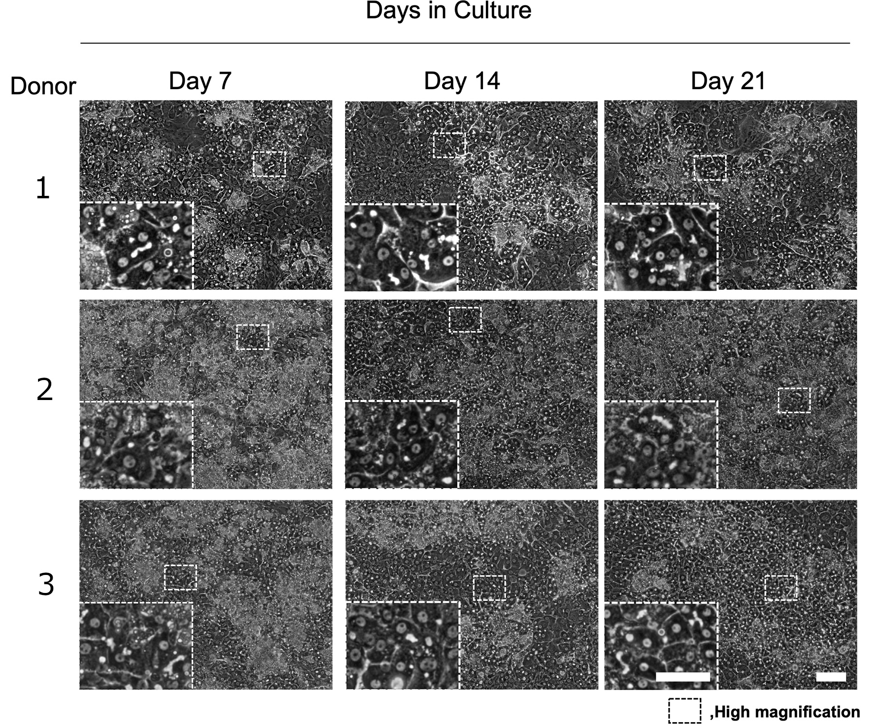 long term PXB-cells